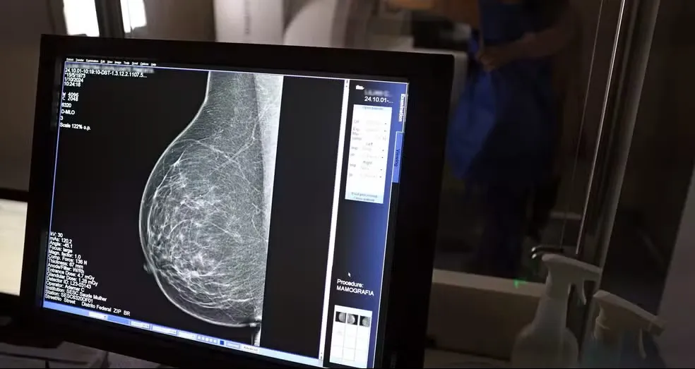 Carreta oferece mamografias gratuitas em Feira de Santana
