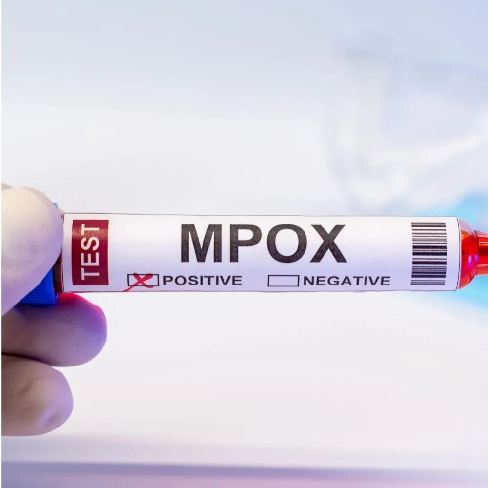 Brasil supera marca de mil casos de mpox em 2024