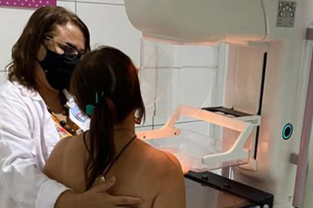 Mamografias podem ser agendadas pelo aplicativo Feira Conectada