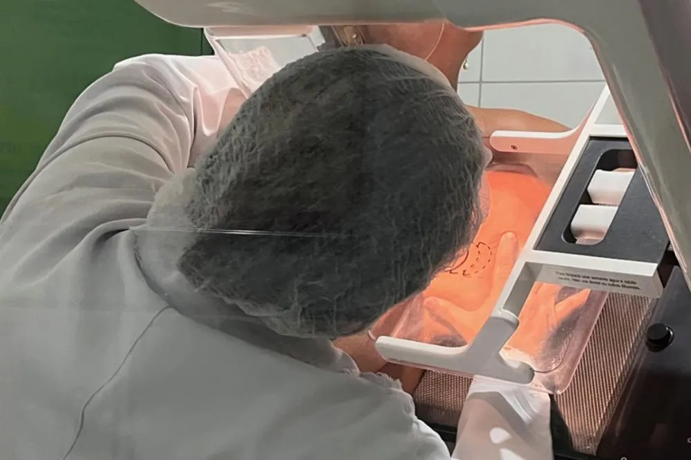 Mês da Mulher: Quase 1.000 vagas para mamografia disponíveis na rede municipal