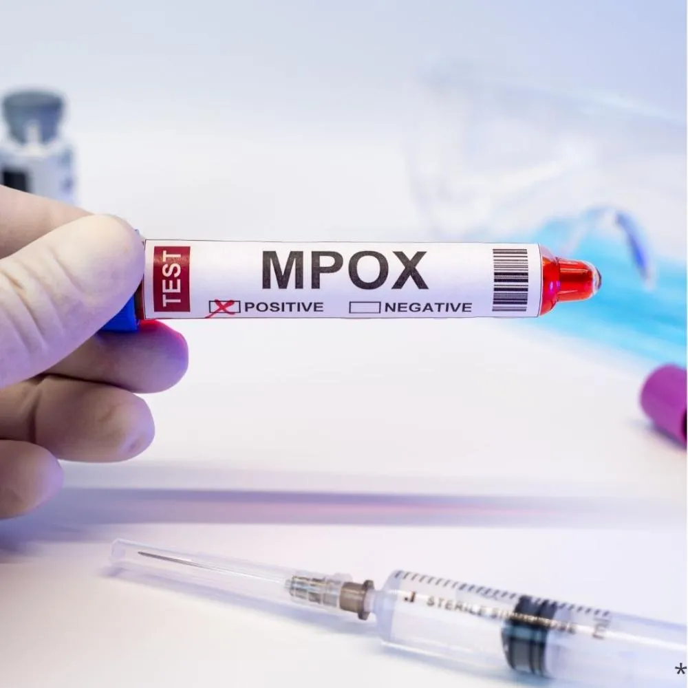 Congo tem mais de 18 mil casos e 615 mortes por mpox
